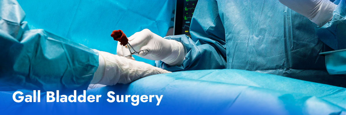 Gall bladder surgery in Siliguri